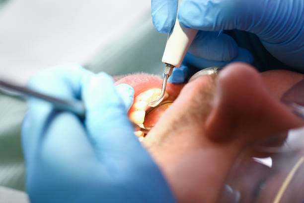 Best Emergency Treatment for Toothache in Gloversville, NY